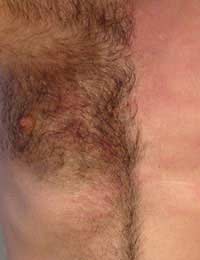 Back Chest Back Wax Chest Wax Hair